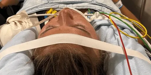Göteborgslöparen Julia Nielsen skadad efter cykelolycka Göteborgslöparen Julia Nielsen skadad efter cykelolycka